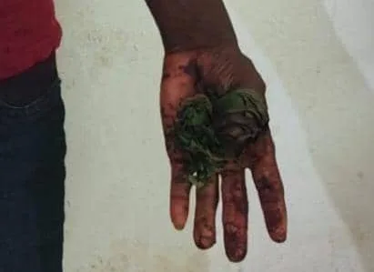Golfe 7 : un citoyen sauvé in extremis des mains de ses agresseurs par la Police